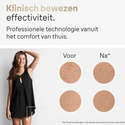 Heren Braun IPL Silk-expert Pro 5