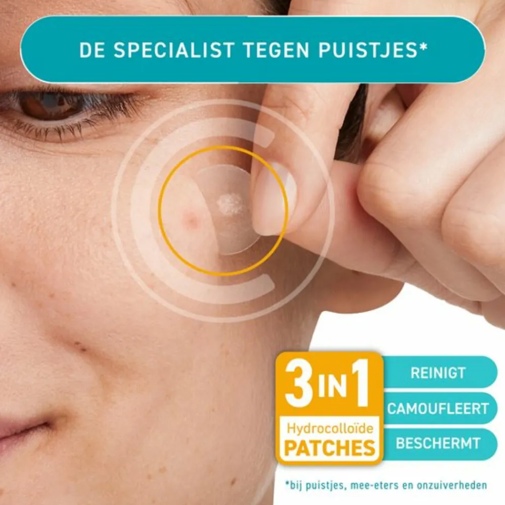 Compeed Anti Spots Small 15 stuks