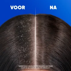 Head & Shoulders 2in1 Citrus Fresh 625 ml