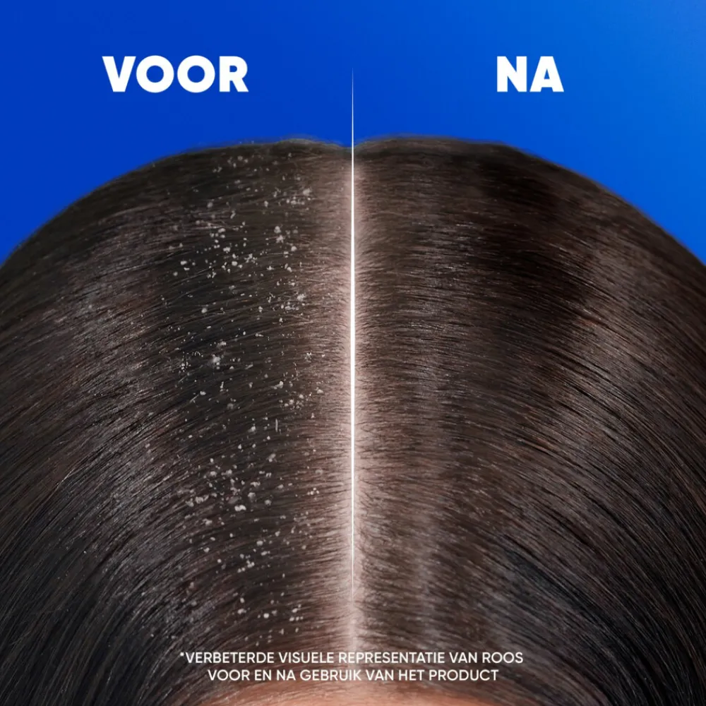 Head & Shoulders 2in1 Citrus Fresh 625 ml