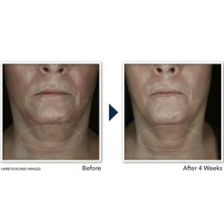 RoC Derm Correxion Contour Cream 50 ml