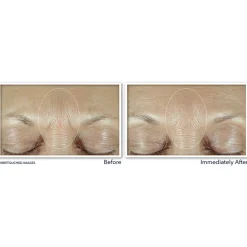 RoC Derm Correxion Fill+ Treat Serum 15 ml