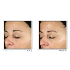 RoC Multi Correxion Revive + Glow Daily Serum 30 ml