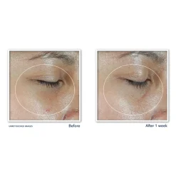 RoC Multi Correxion Revive + Glow Eye Stick 4 gr