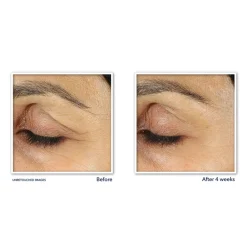 RoC Retinol Correxion Line Smoothing Oogcrème 15 ml