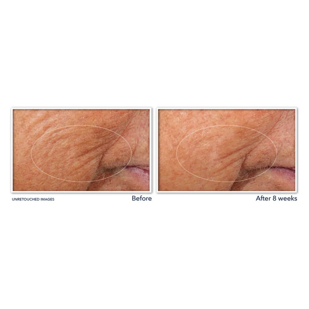 RoC Retinol Correxion Serum Nacht 30 stuks