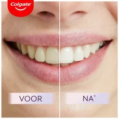 Colgate 6x Tandpasta Max White Ultimate 75 ml